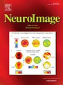 Neuroimage