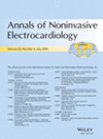 Annals Of Noninvasive Electrocardiology